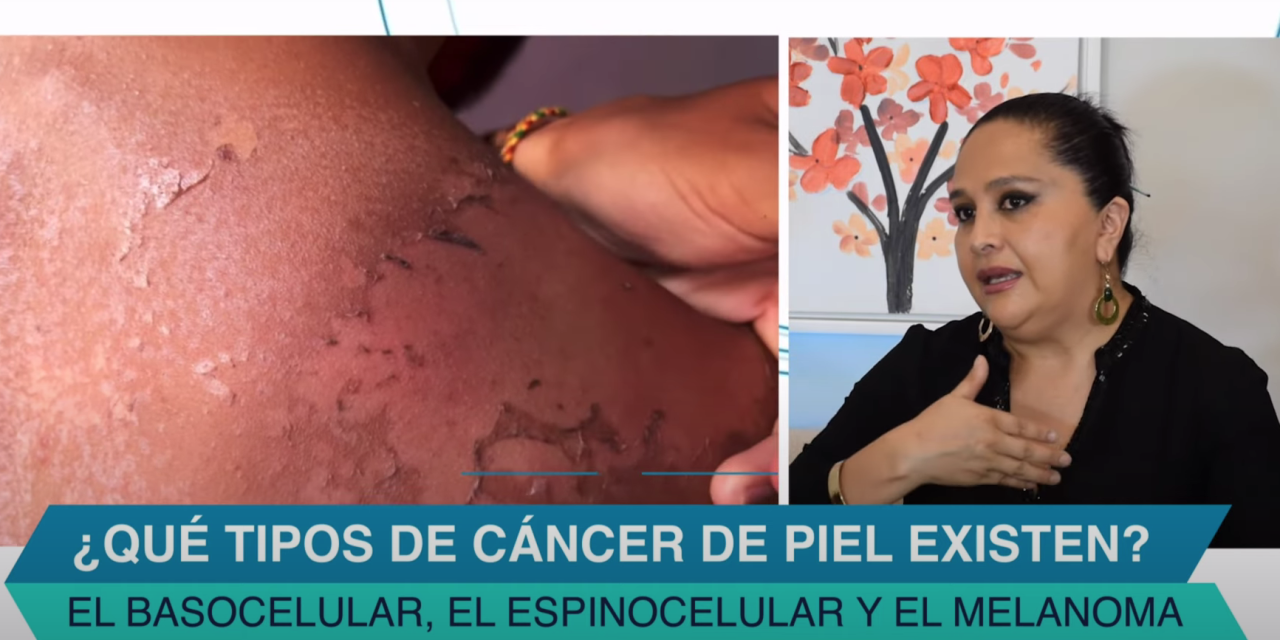 Cáncer de piel – Podcast